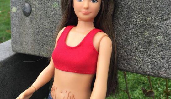 A apărut Barbie cu celulită și vergeturi!