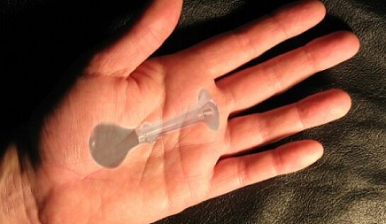 Premieră medicală! Un taximetrist și-a implantat un claxon în palmă pentru a-l folosi și ca pieton!