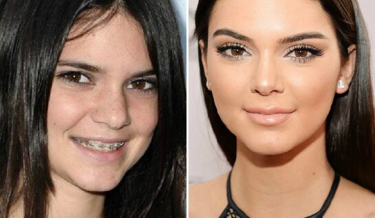 12 fotografii care arată transformarea lui Kendall Jenner, din 2007 până astăzi