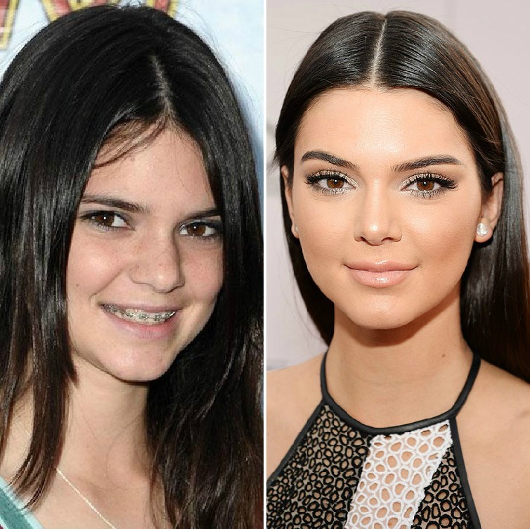 12 fotografii care arată transformarea lui Kendall Jenner, din 2007 până astăzi