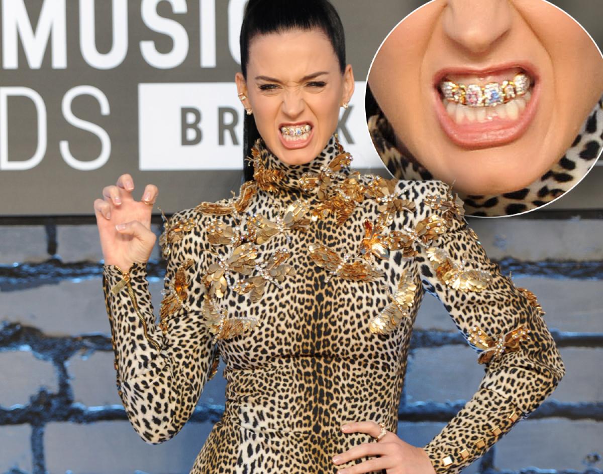 FOTO: 9 cântăreți care au purtat aparat dentar