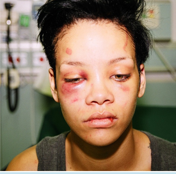 TOP 4 momente în care Rihanna a fost motiv de bătaie. #ZUTOPIA