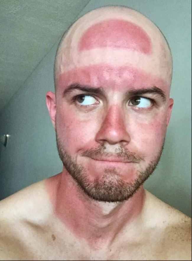 WTF. 14 oameni pe care soarele i-a „tatuat în cel mai dubios mod