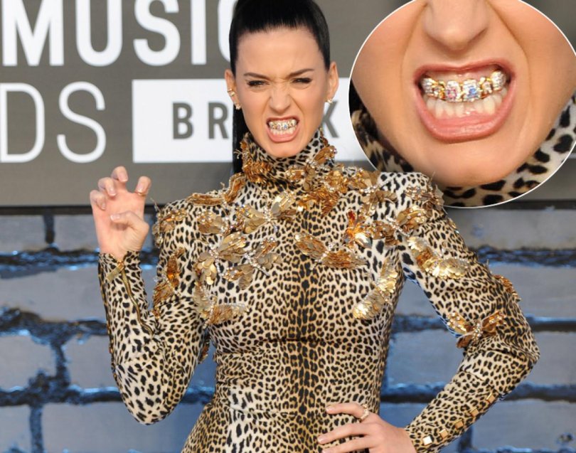 FOTO: 9 cântăreți care au purtat aparat dentar