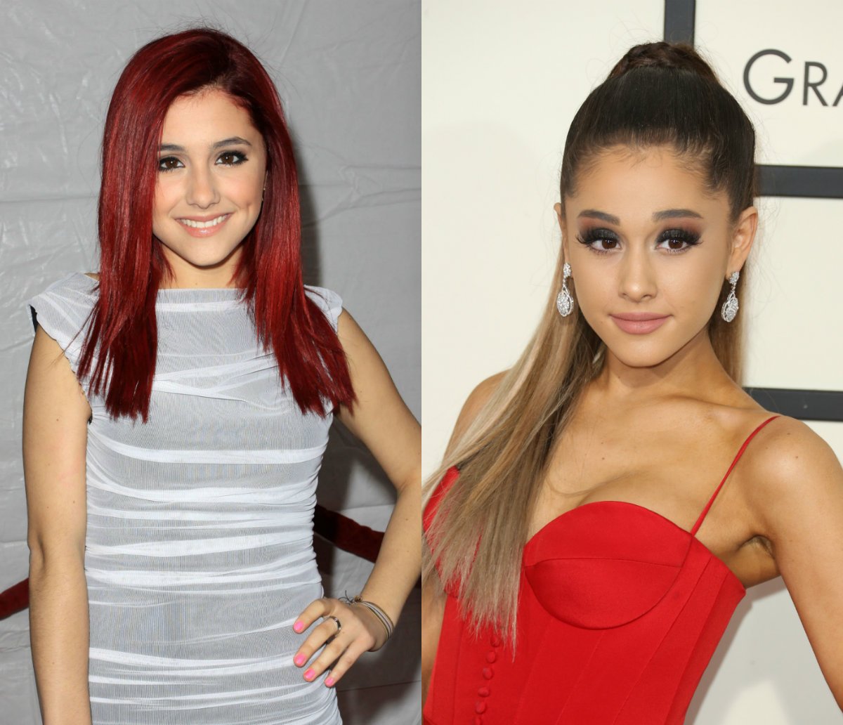 FOTO | TOP 11 celebrități înainte și după operațiile estetice