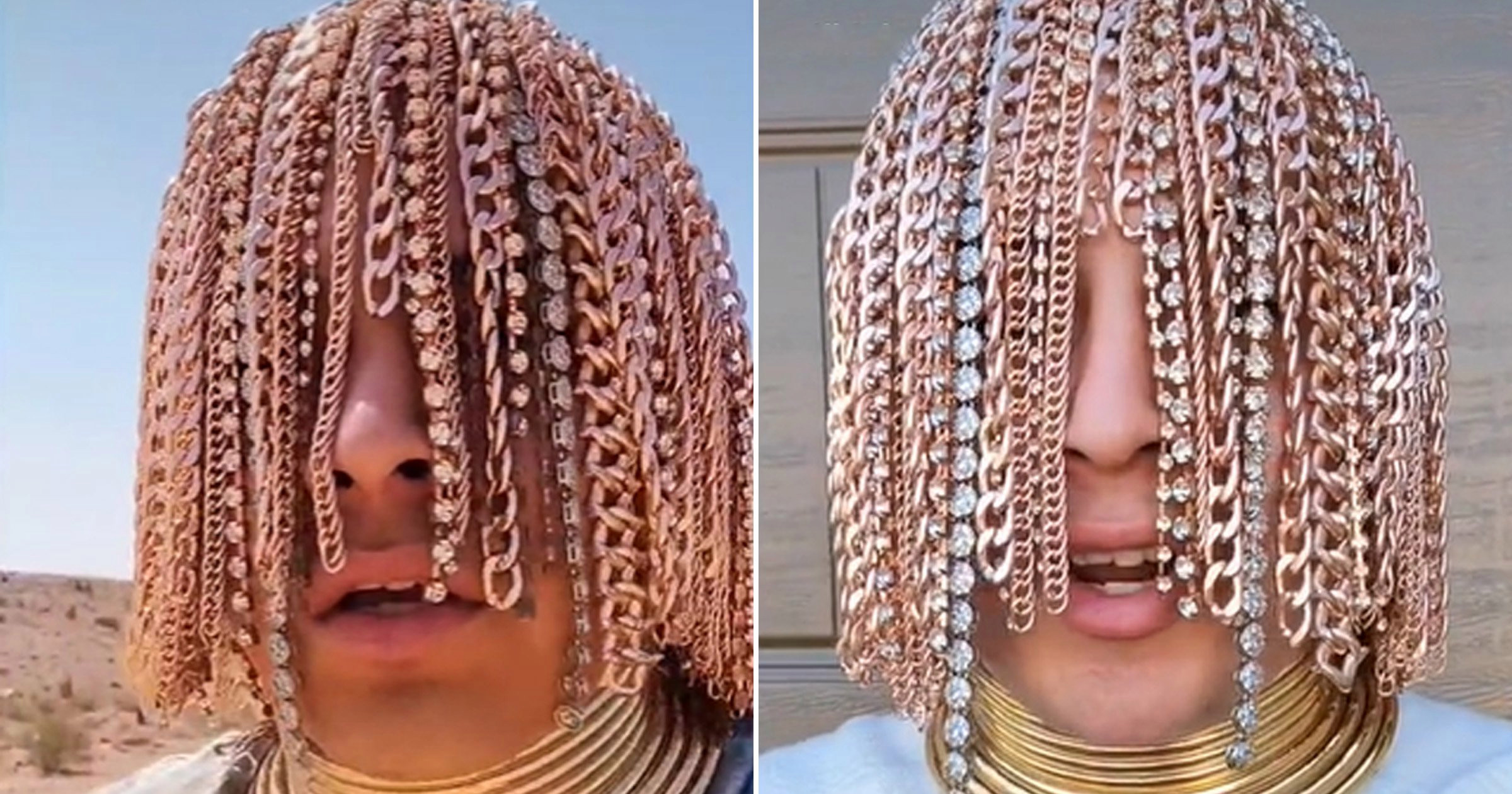 Stai, ce?! Un rapper a renunțat complet la păr și și-a implantat bijuterii în cap
